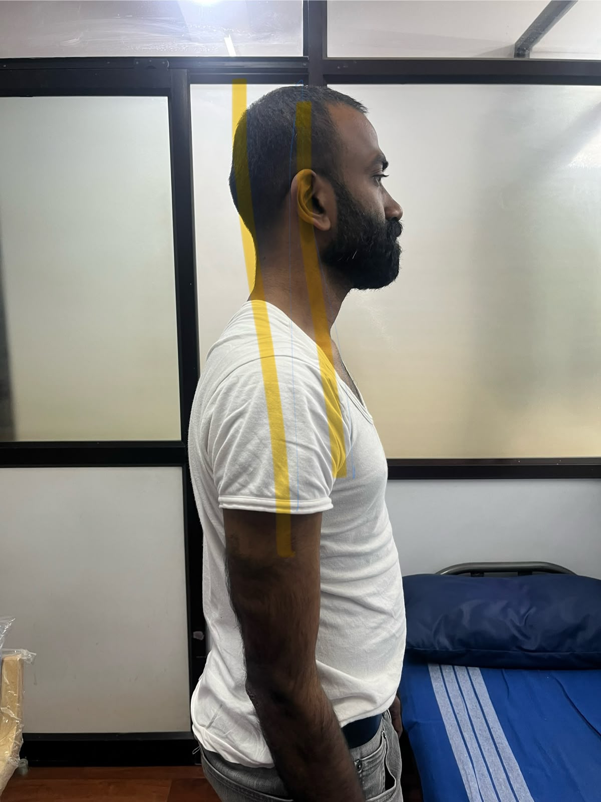 Posture assessment with plumb-line analysis